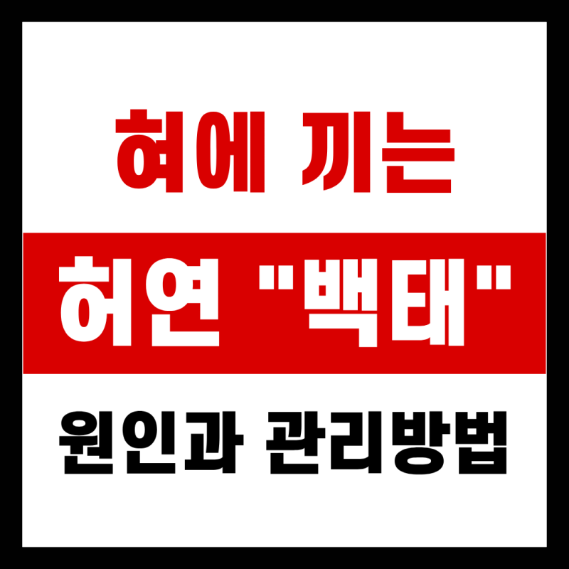혀에 백태 끼는 원인과 관리방법 총정리