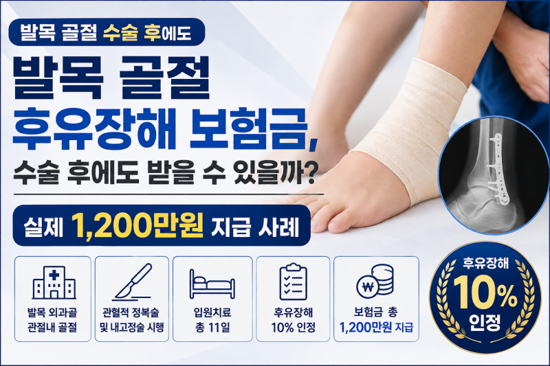 발목 골절 후유장해 보험금, 수술 후에도 받을 수 있을까? 실제 1,200만원 지급 사례