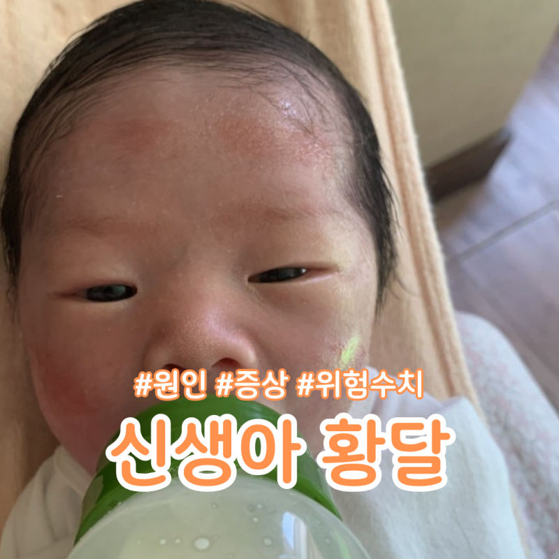 신생아 황달 원인 증상, 수치 몇부터 위험할까?