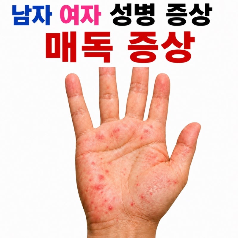 남자 여자 성병 증상 매독 발진 모양 이렇게 나타납니다