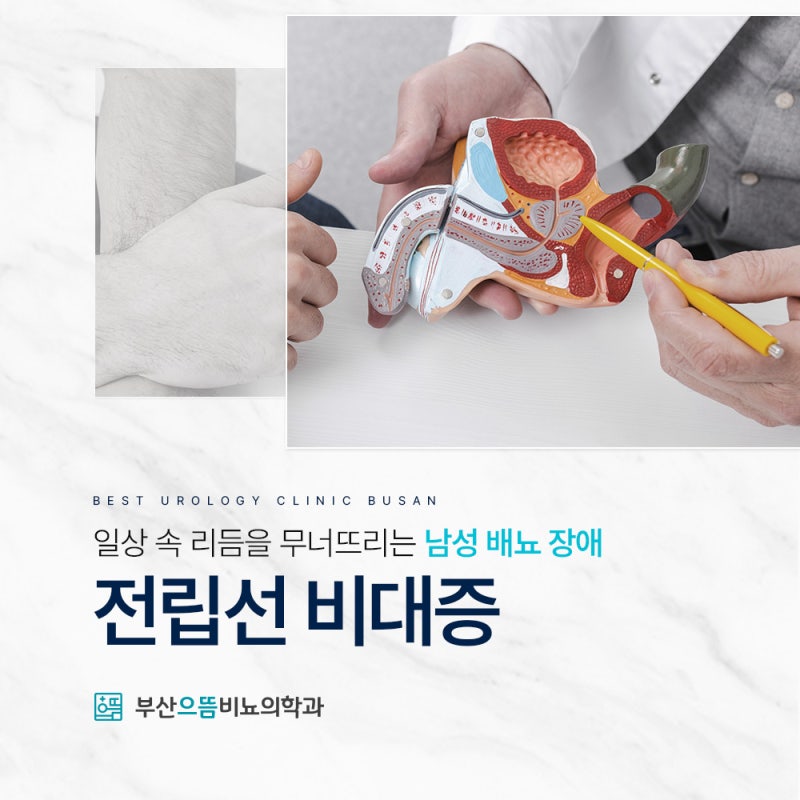 부산비뇨기과의원 전립선비대증 2가지 치료 방법 각각의 특징은?