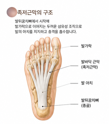 족저근막염 마사지, 발바닥만 풀어서는 부족한 이유