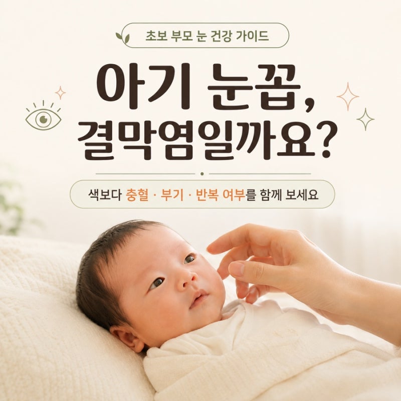 아기 눈꼽, 신생아 노란 눈꼽과 아기 눈 충혈은 결막염일까?
