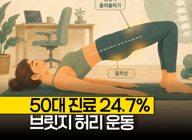 "50대 진료 24.7%" 허리 근육 강화 브릿지 자세 운동, 척추기립근운동에 도움 될까?