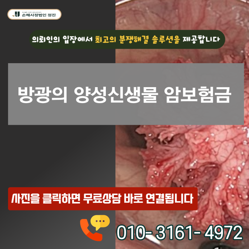 방광의 양성신생물 암보험금, D30.3 코드인데 정말 경계성암 진단비 못 받을까?