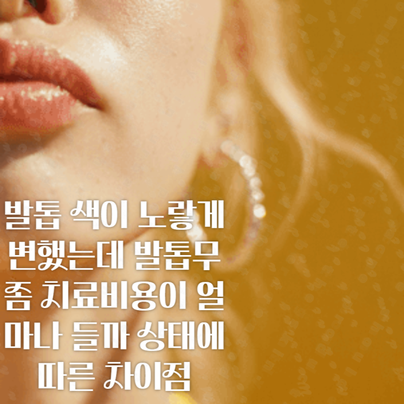 발톱 색이 노랗게 변했는데 발톱무좀 치료비용이 얼마나 들까 상태에 따른 차이점