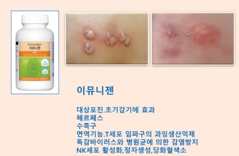 면역력 떨어졌을 때 나타나는 신호부터 헤르페스와 대상포진까지 면역 건강을 챙기는 아연 ....