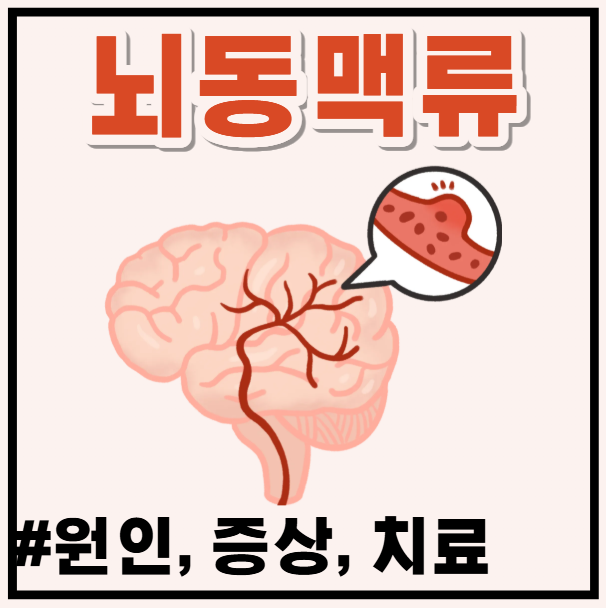 갑작스러운 두통? 뇌동맥류 증상과 원인, 치료 방법 안내