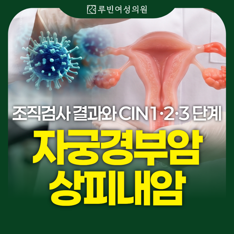 자궁경부암 상피내암, 조직검사 결과와 CIN1·2·3 단계 알아보기