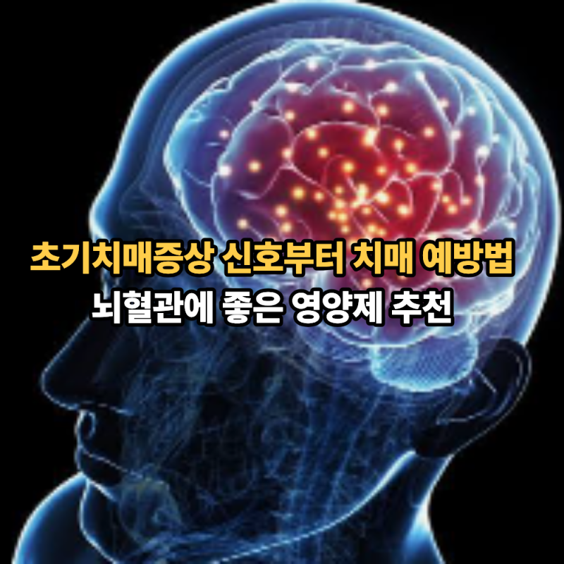 초기치매증상 신호부터 치매 예방법