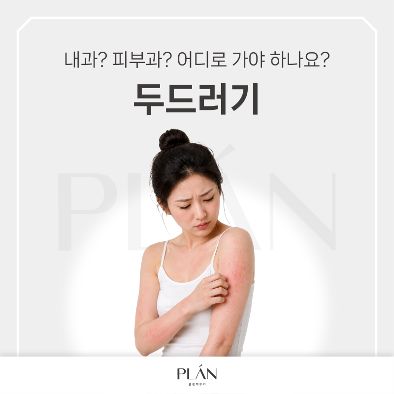 김포 피부과, 내과? 피부과? 어디로 가야 하나요? "두드러기"