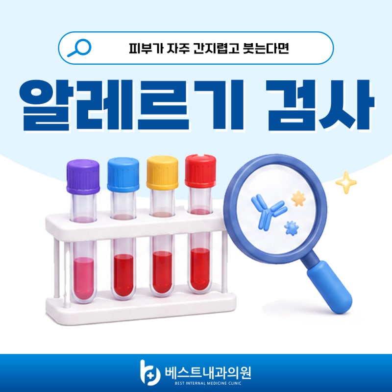 [대전 마스트(MAST)검사 병원] 알레르기 원인 108종 검사