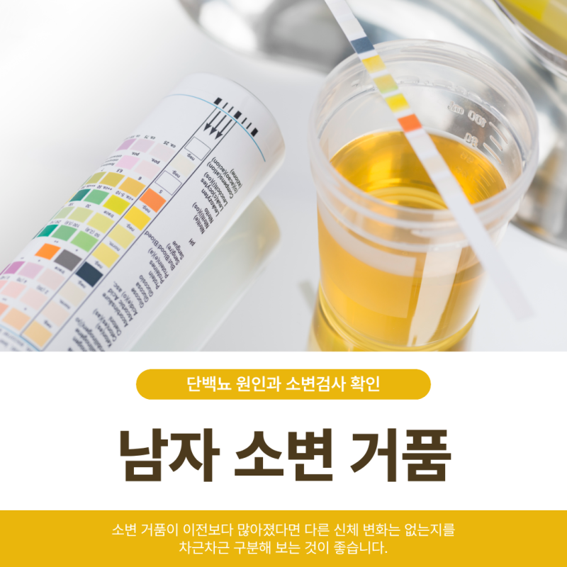 남자 소변 거품 많아졌다면 단백뇨 원인과 소변검사 확인