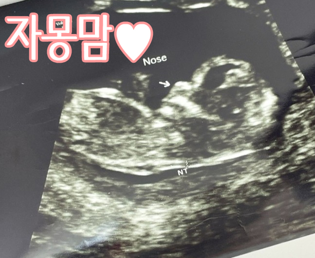 임신초기 아랫배 묵직 나옴 당김 콕콕 쑤심 통증 설사
