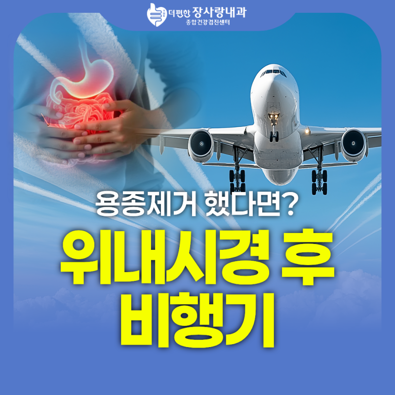 위내시경 후 비행기 타도 될까? 용종제거 했다면?
