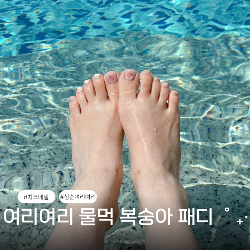 대구 동성로 네일샵 예뻐질곧 치크네일 자석패디 젤제거 무료