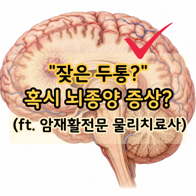 "잦은 두통과 건망증" 뇌종양 증상 5가지는 뭘까? (ft. 암재활전문 물리치료사)