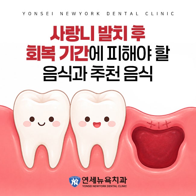 사랑니 발치 후 회복 기간에 피해야 할 음식과 추천 음식