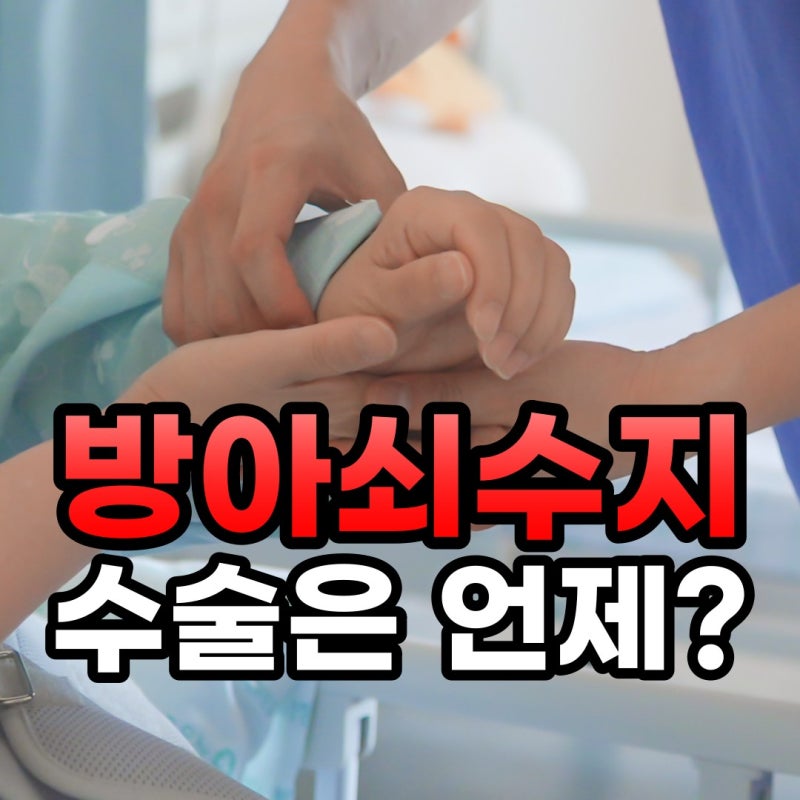 방아쇠수지 수술까지 해야 할까요? 수술비와 회복기간 정리