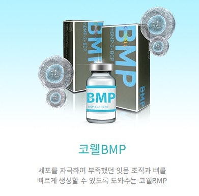 해운대 뼈이식임플란트, 사용하는 뼈이식재 어떤 종류