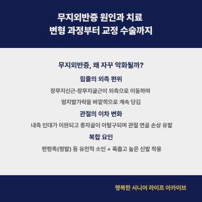 무지외반증 원인과 치료 | 변형 과정부터 교정 수술까지