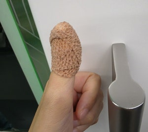 병원 재방문 없이 실비 청구하기 | 손가락 꼬맴(봉합) 실비 청구 후기, DB손해보험 앱으로