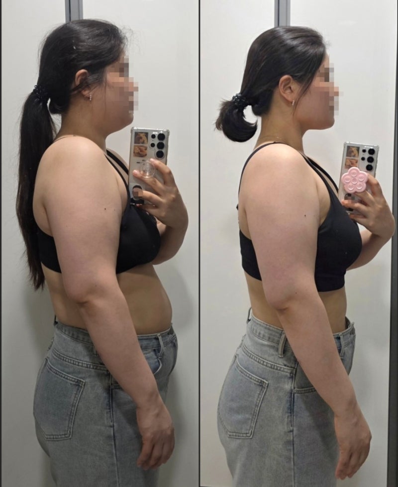 최종 스위치온 다이어트 4주차 후기｜7kg 감량, 전후 사진으로 보는 변화