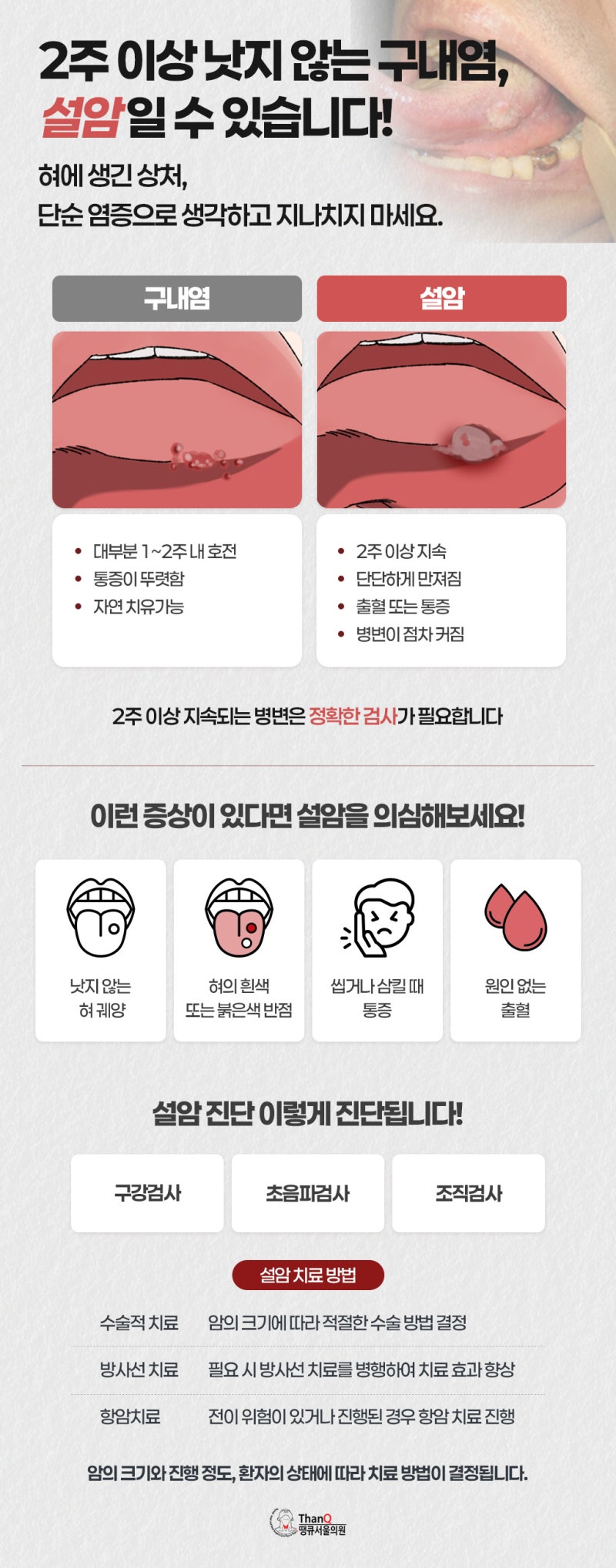 구강암의 종류는 어떤 것이 있을까?