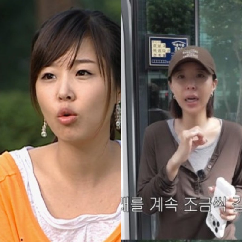 코요태 신지 양악수술 의혹의 진실? 직접 밝힌 턱관절 보철 치료 내막