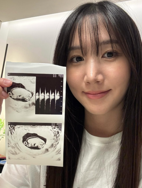 에이핑크 홍유경 근황, 의사 남편과 신혼 일상 속 과거 탈퇴 논란 재조명