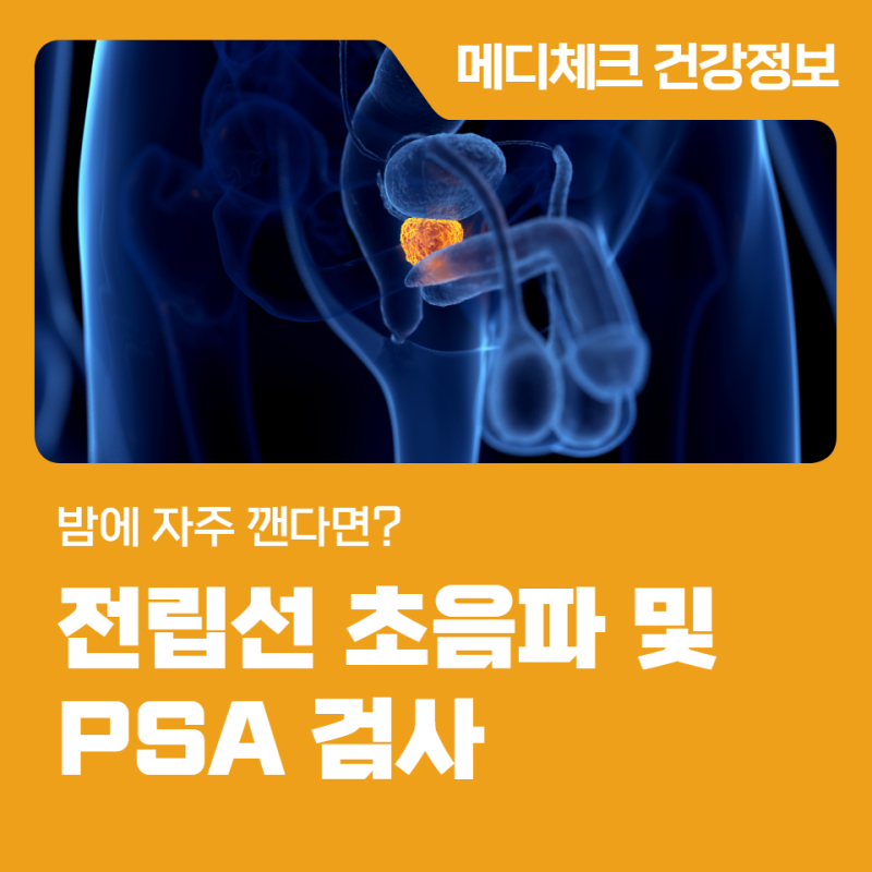 경남 한국건강관리협회 밤에 자주 깬다면? 전립선 초음파 및 PSA 검사
