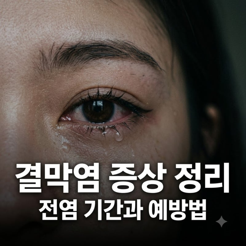 결막염 증상 원인 총정리 아기 눈꼽 충혈 전염 예방법