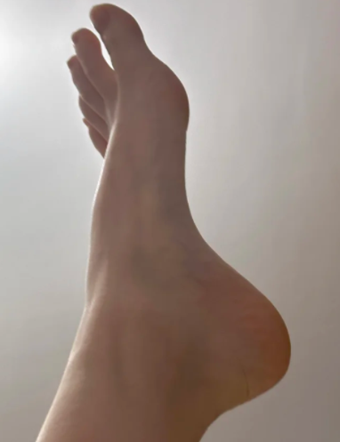 발목염좌 회복기간 등급별로 정리했어요