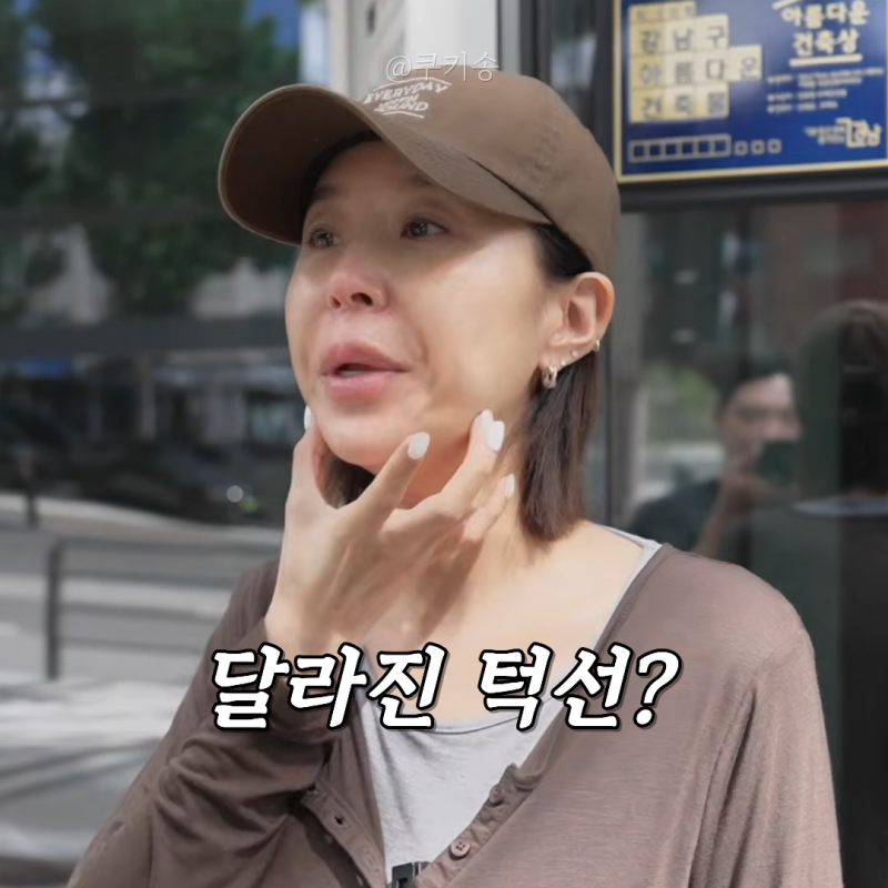 "달라진 턱선?" 코요태 신지 양악수술 성형 의혹 해명과 다이어트 근황