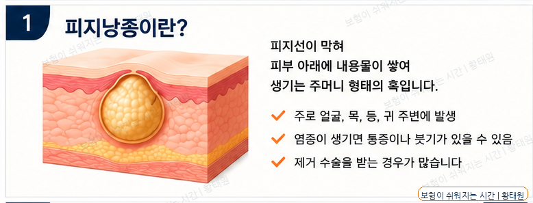 피지낭종 제거 수술, 보험금 받을 수 있을까?