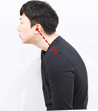 목디스크 초기 증상과 자가 확인, 치료 단계와 수술 기준까지