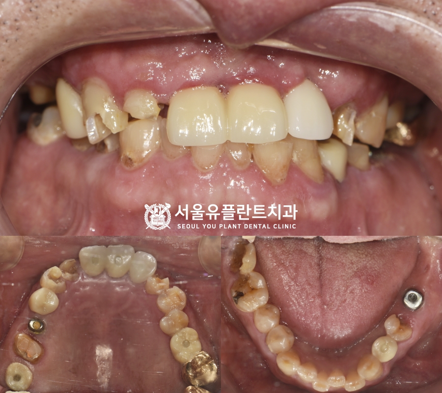 진정 사진 2