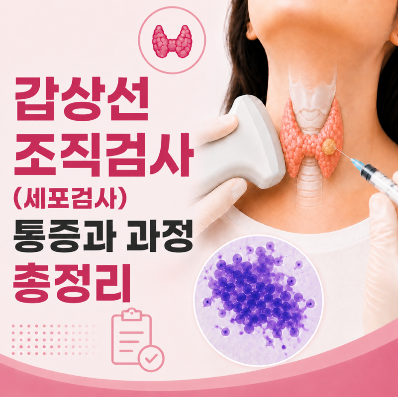 갑상선 조직검사(세침흡인세포검사), 통증과 과정 총정리