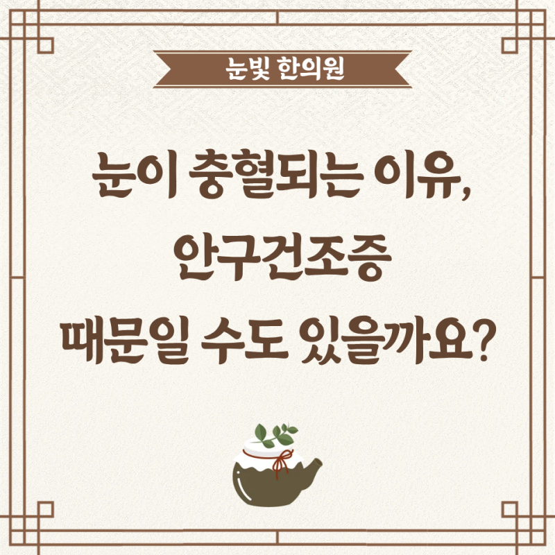 눈이 자꾸 충혈되는 이유, 안구건조증 때문일 수도 있을까요?