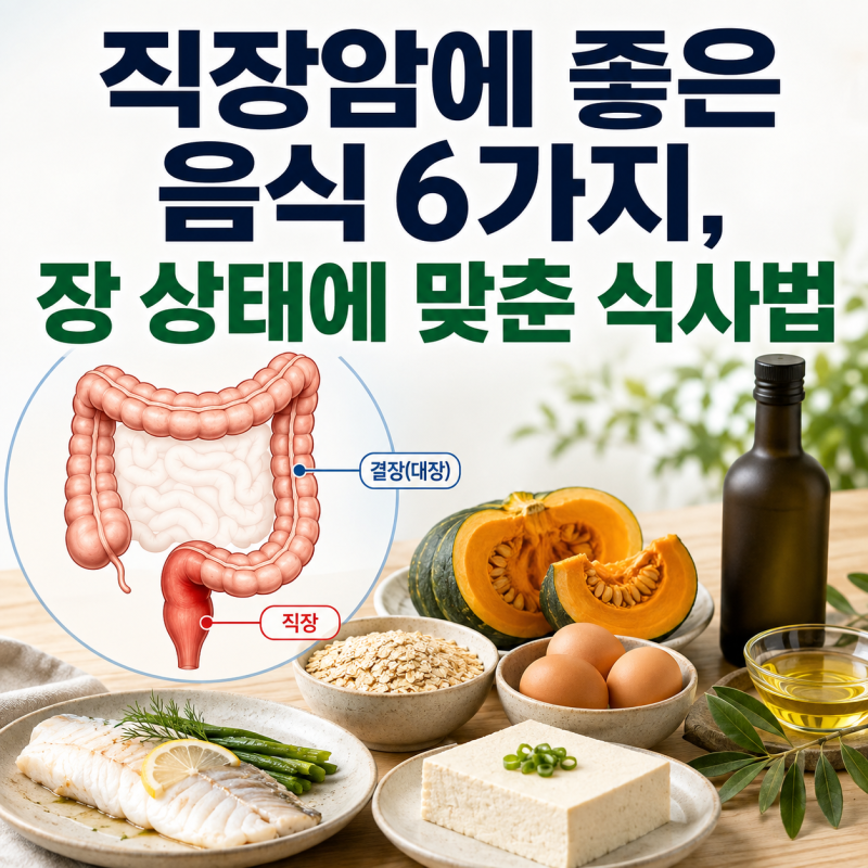 직장암에 좋은 음식 6가지, 장 상태에 맞춘 식사법