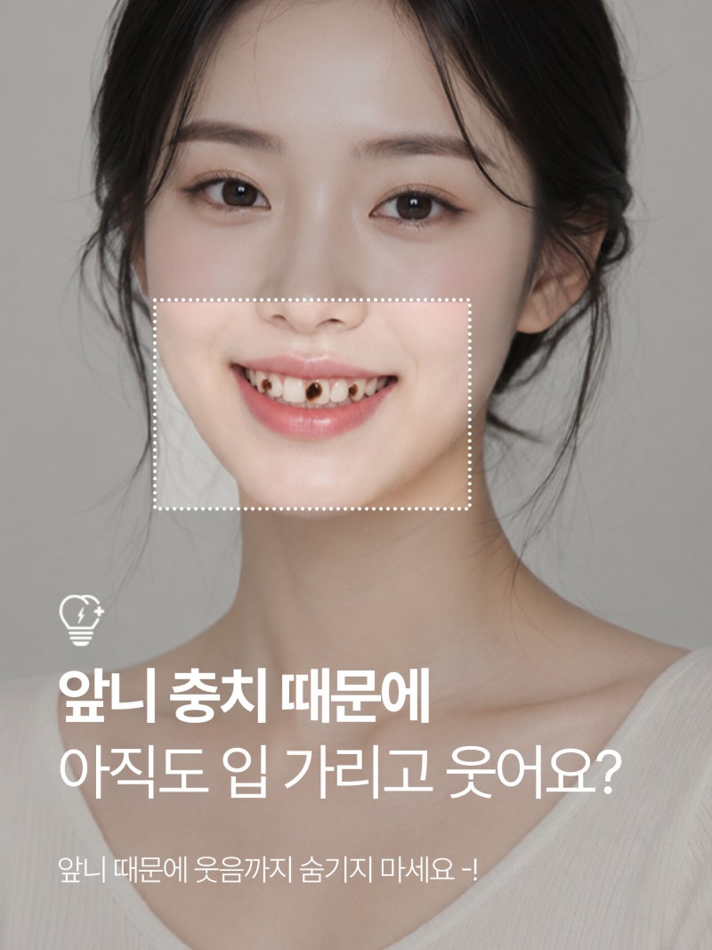 앞니 충치 때문에 입 가리고 웃는다면? 단계별 치료방법