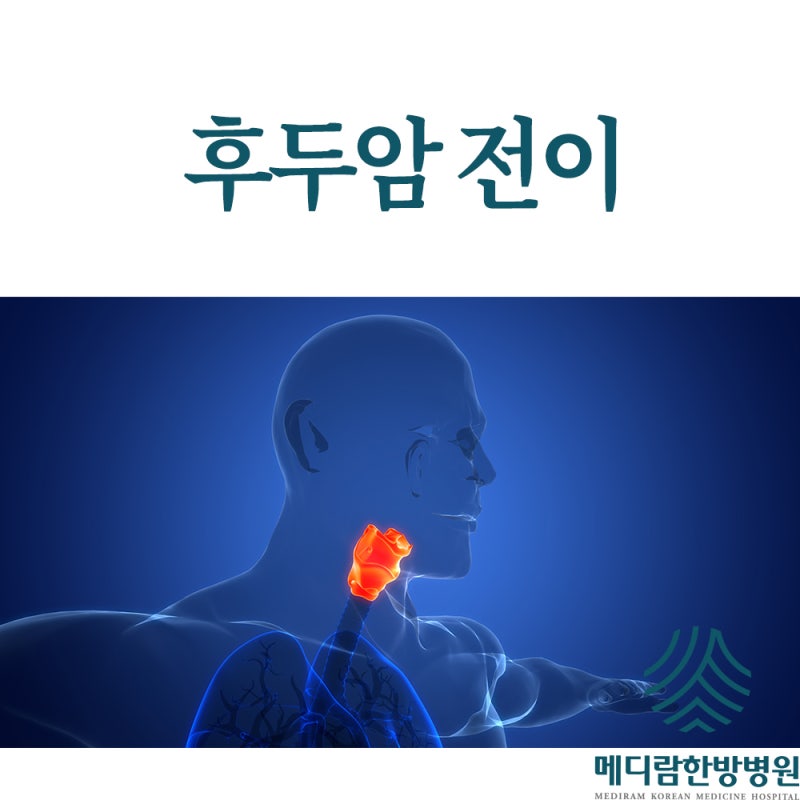 후두암 전이 초기증상 속도 치료법 예후 총정리