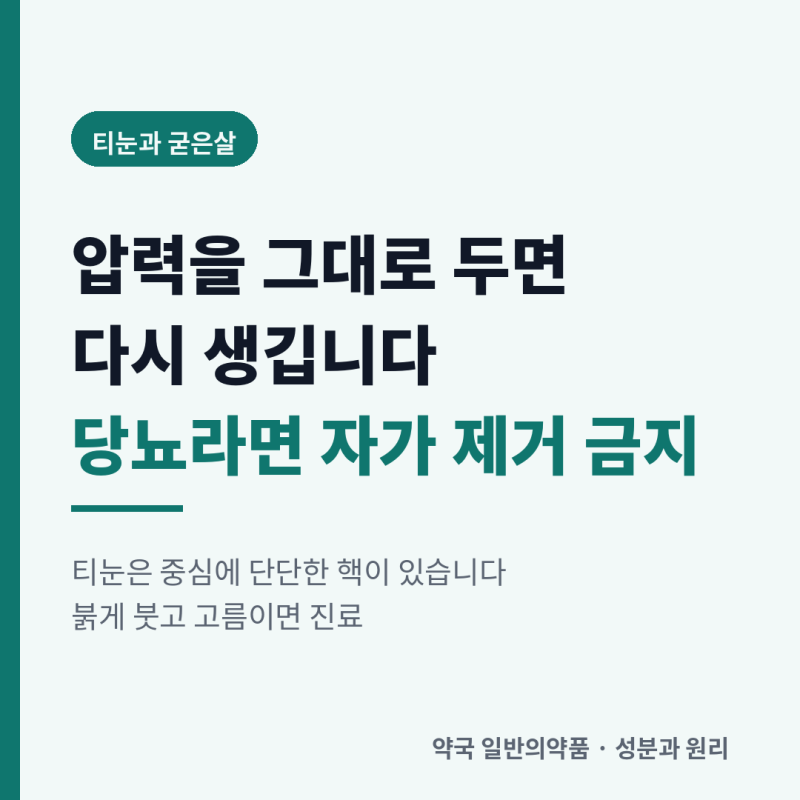 티눈과 굳은살은 다릅니다 — 붙이는 약을 쓰기 전에 확인할 것 (그리고 당뇨가 있다면)