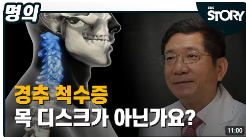 EBS 명의 허리 척추 질환 의사 총정리(허리디스크, 목디스크 등)