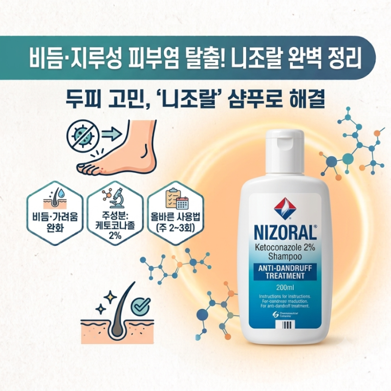 머리 가려움·비듬 심할 때? '지루성 피부염' 잡는 케토코나졸 효과와 올바른 사용법