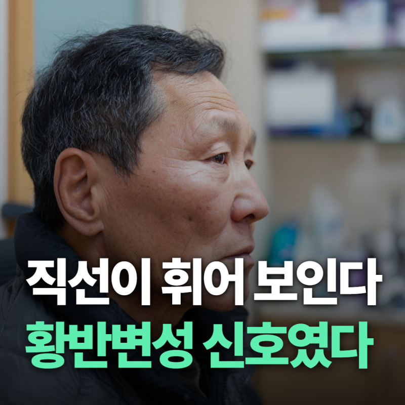 황반변성 증상 초기증상 눈앞흐림 사물왜곡 자가진단 테스트 방법