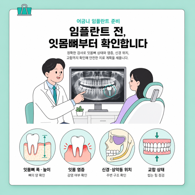 어금니 임플란트 과정, 임플란트 준비한다면 알아두세요