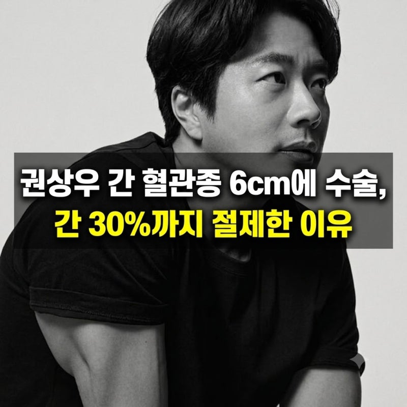 권상우 간 혈관종 6cm에 수술,간 30%까지 절제한 이유