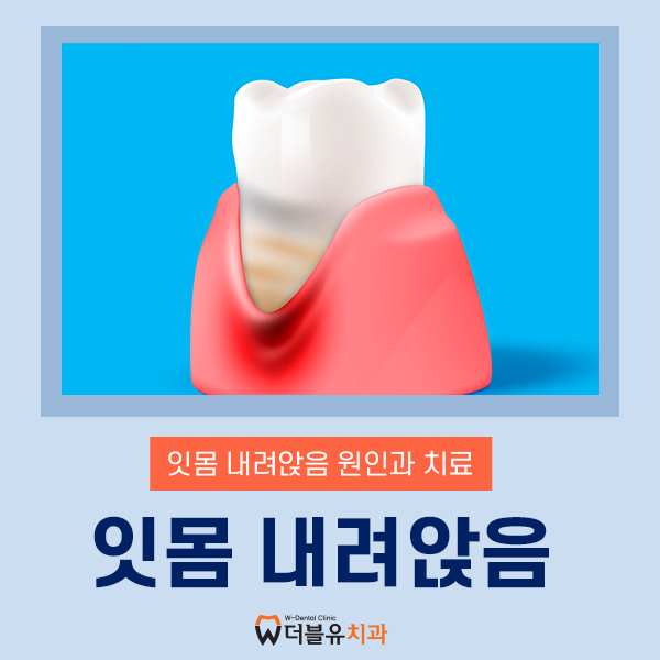 잇몸 내려앉음 치료, 약이나 치약으로 좋아질 수 있을까요?