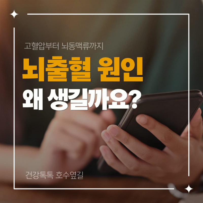 뇌출혈 원인, 왜 생길까요? 고혈압부터 뇌동맥류까지